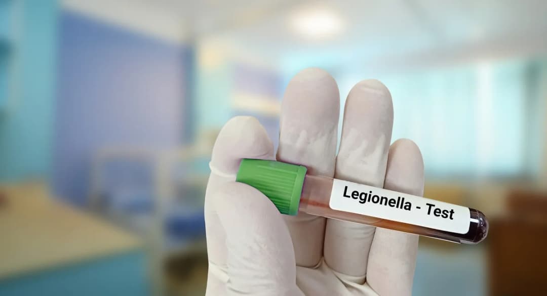 Number of UES buildings with positive Legionella tests more than doubles since preliminary findings - Gothamist
