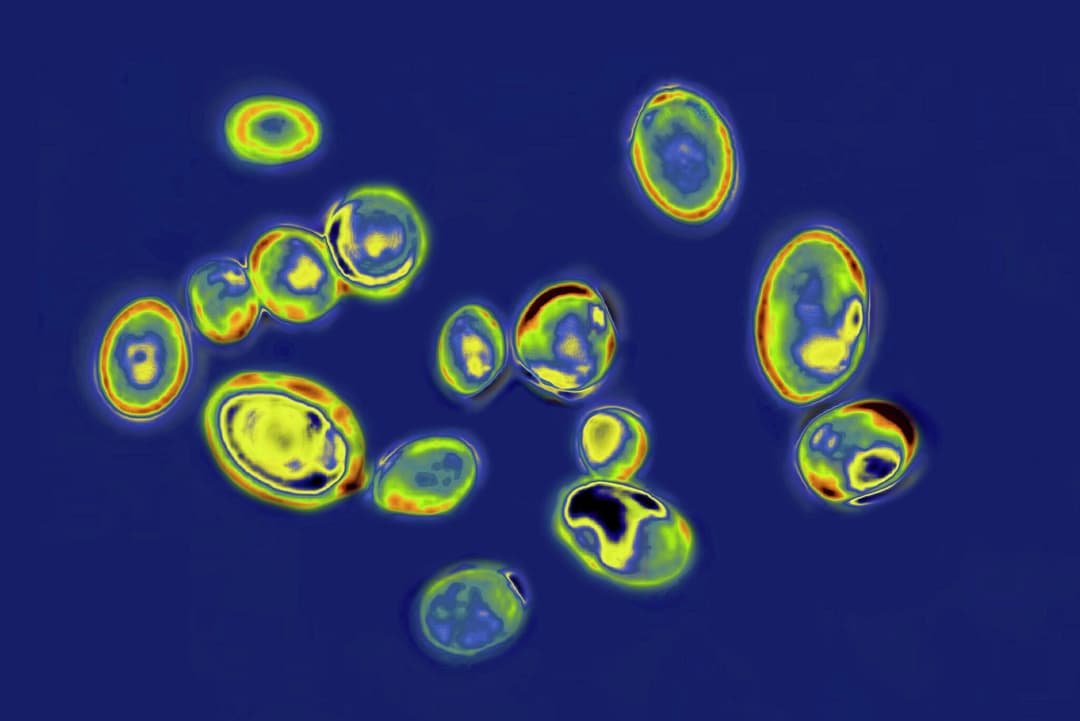 Texas leads nation in Candida auris cases as the drug-resistant fungus spreads - Houston Chronicle