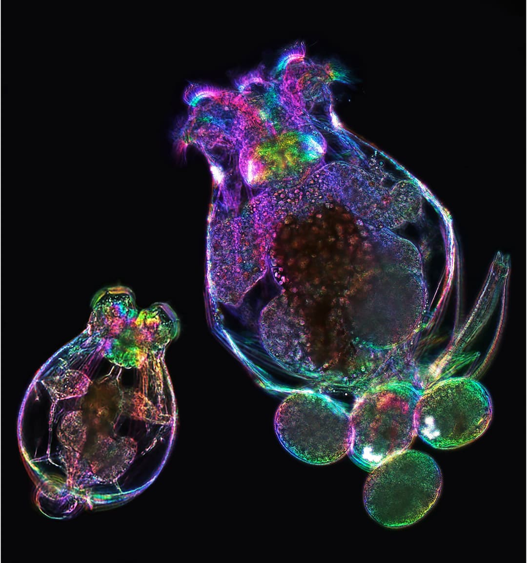 Molecular memory: How a mother's age echoes in her offspring's cells - Phys.org